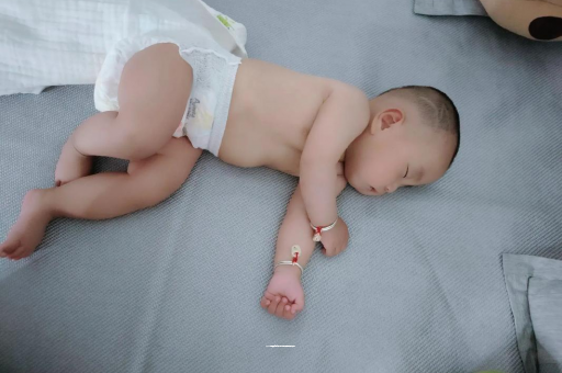 北海六个月宝宝眼睛散光 北海六个月宝宝眼睛散光